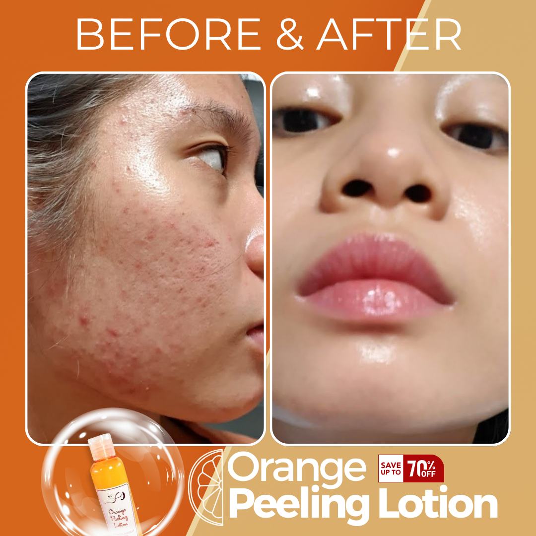 Orange Peeling Lotion