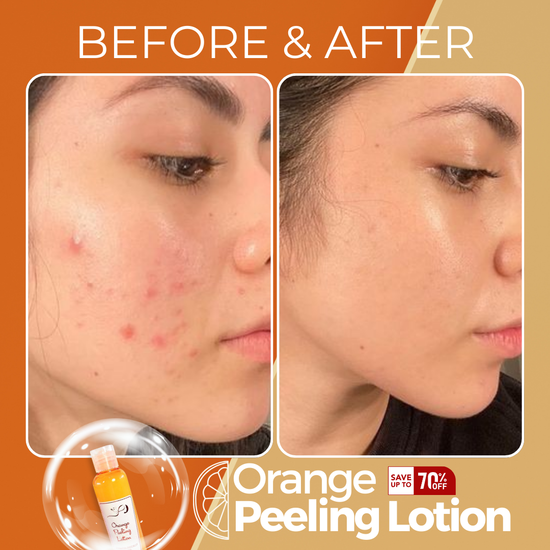 Orange Peeling Lotion