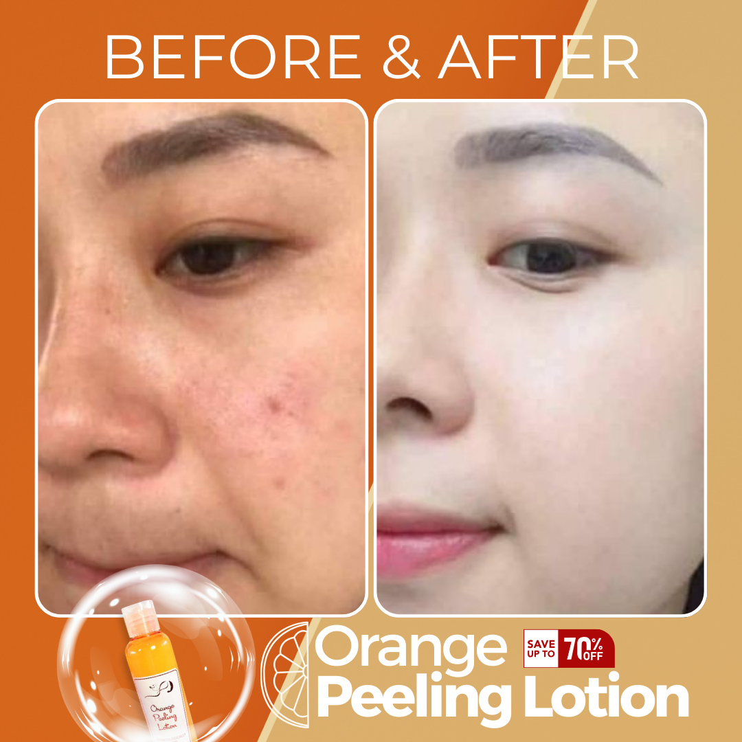 Orange Peeling Lotion