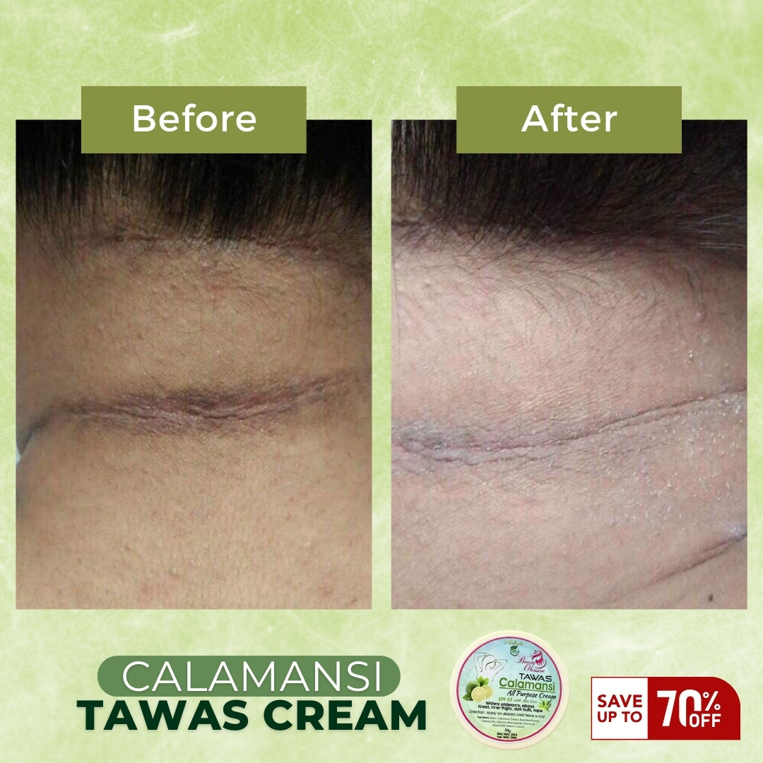 Calamansi Tawas Cream